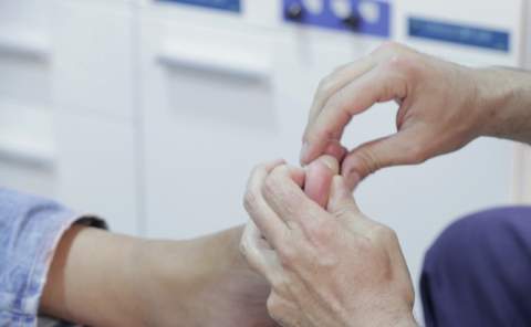 ‘Dedos en salchicha’: el síntoma silencioso de enfermedades reumatológicas que los podólogos ayudan a aliviar