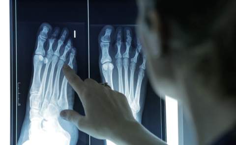 El sedentarismo debilita los pies y aumenta el riesgo de lesiones y caídas