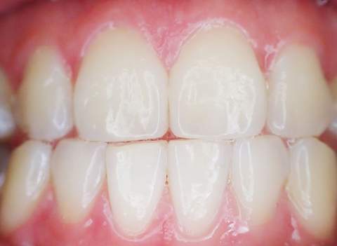 Los dentistas de Castellón alertan del auge de pseudoterapias y tratamientos virales sin control profesional